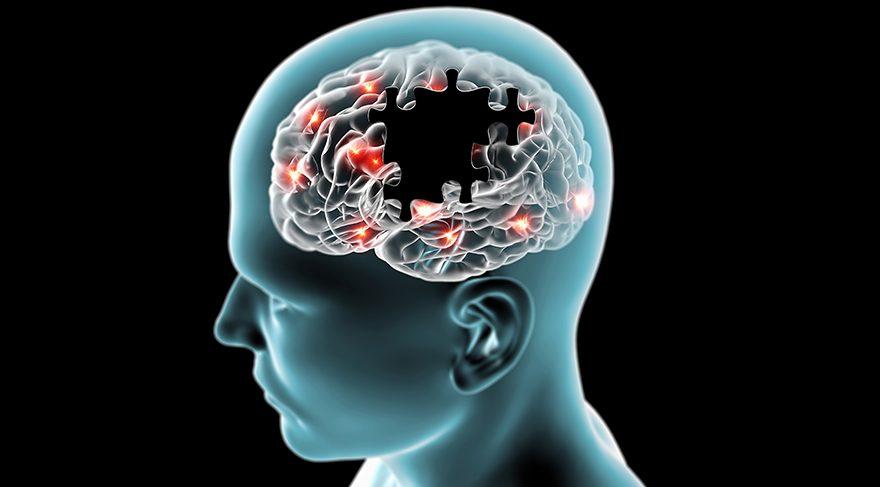 Bitkisel içerikli teknoloji ile Alzheimer tedavisi – Birlik Haber Ajansı