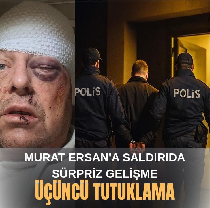 Gazeteci Murat Ersan’a saldırı Yapıldı