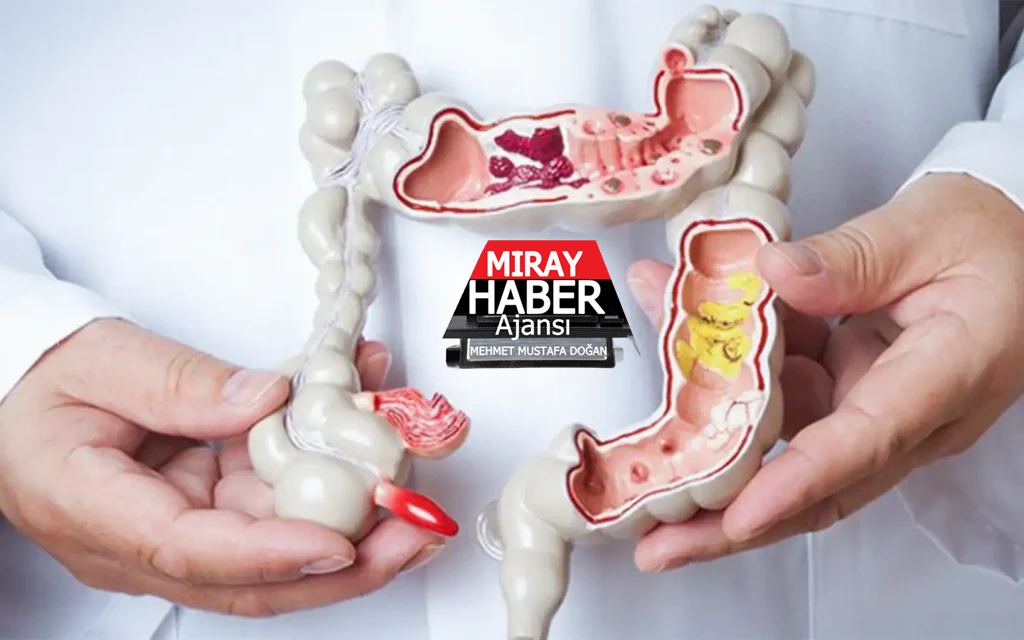 Her gün yaşanan ishal ve karın ağrısı İBH sinyali olabilir